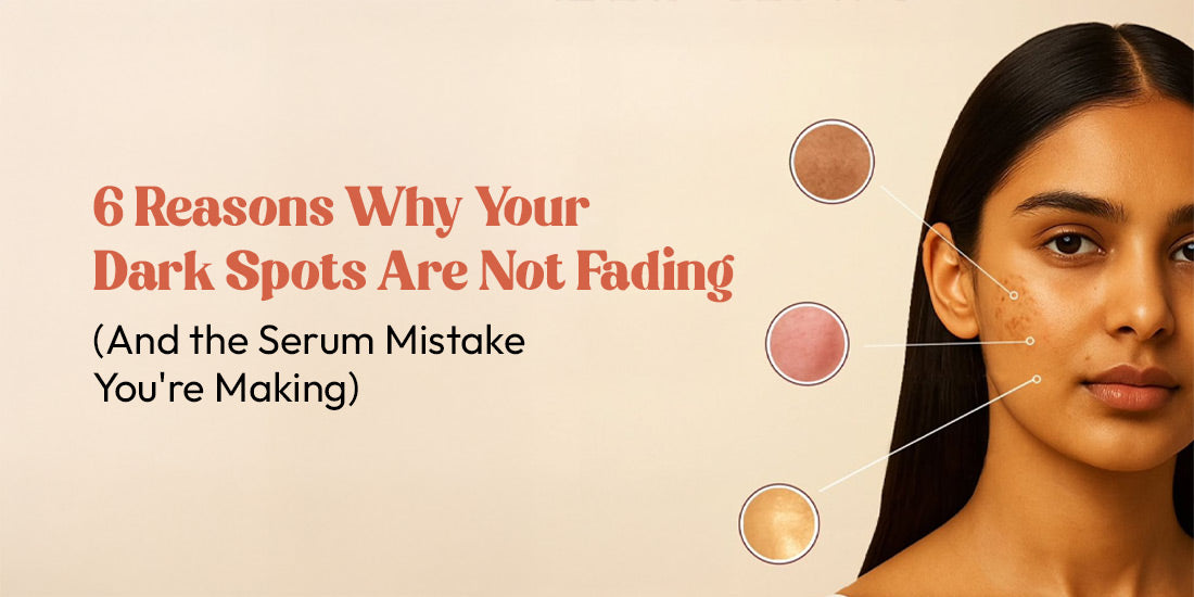 dark spots are not fading